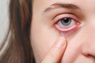 Understanding Swelling Inside Eye: Causes, Symptoms, and Care