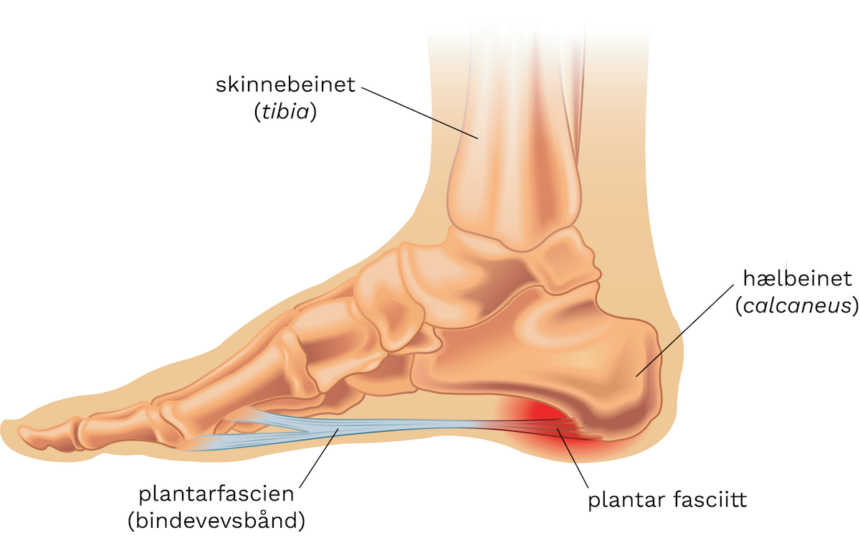 Understanding Fotbladet: A Guide to the Sole of the Foot