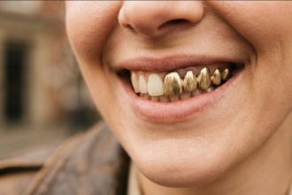 The Ultimate Guide to the Brasssmile Trend: Everything You Need to Know